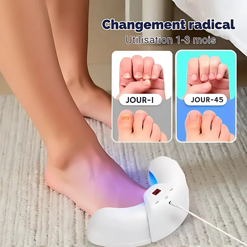 Dispositif LED anti-mycoses des ongles – Soin rapide et naturel