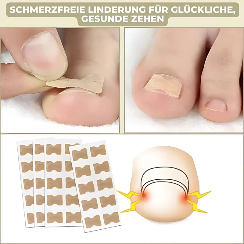 FixaNail Patches de réparation instantanée pour ongles